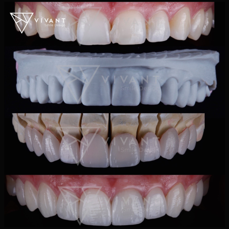 VIVANTSMILEDESING3-768x768