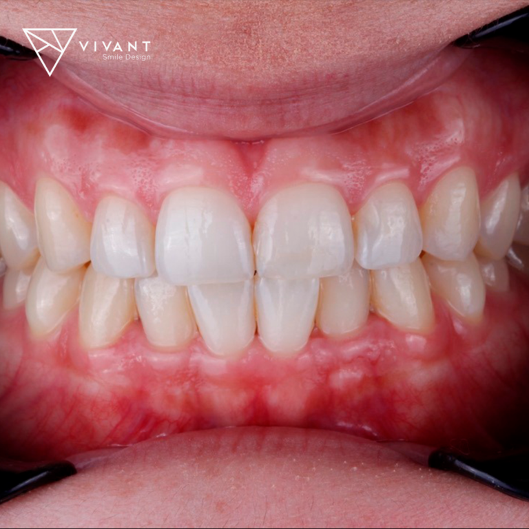 VIVANTSMILEDESING6-768x768