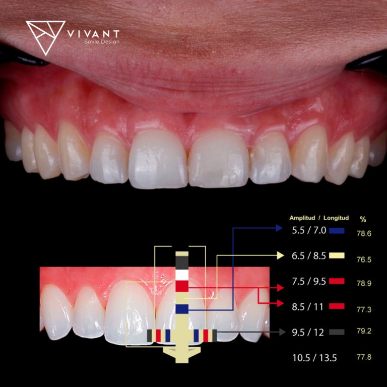 VIVANTSMILEDESING7-768x768