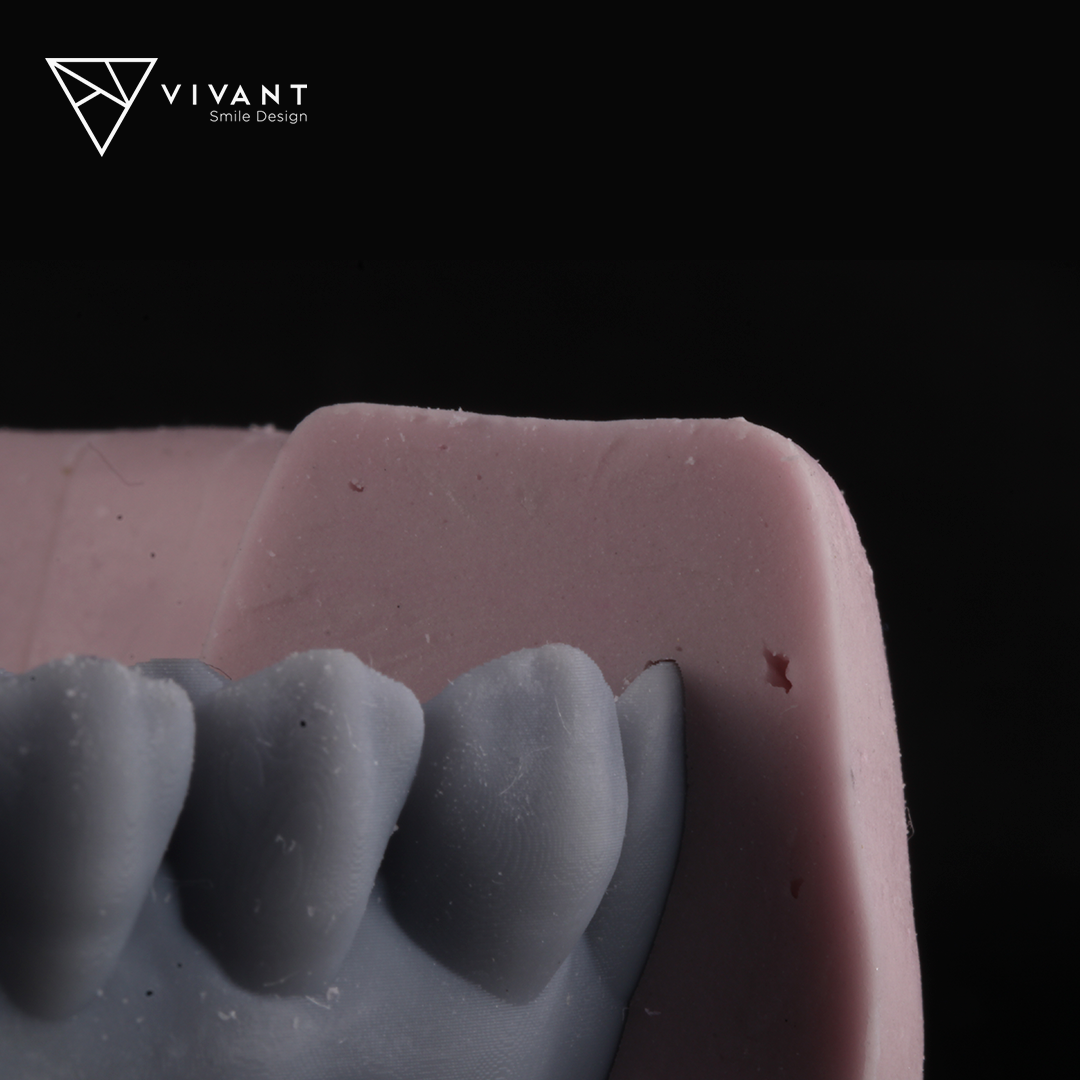 Vivantsmiledesingcasosmile9