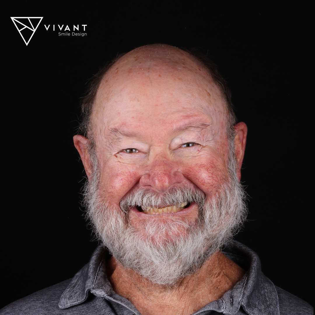 Vivantsmiledesinglosalgodonescrowns1png-1