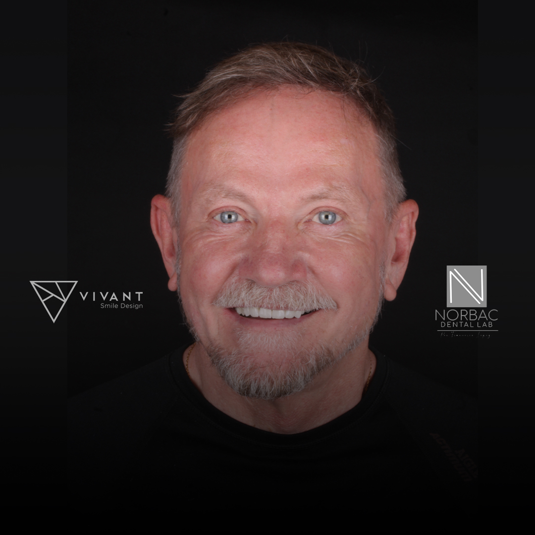 clinicdentalinmexico