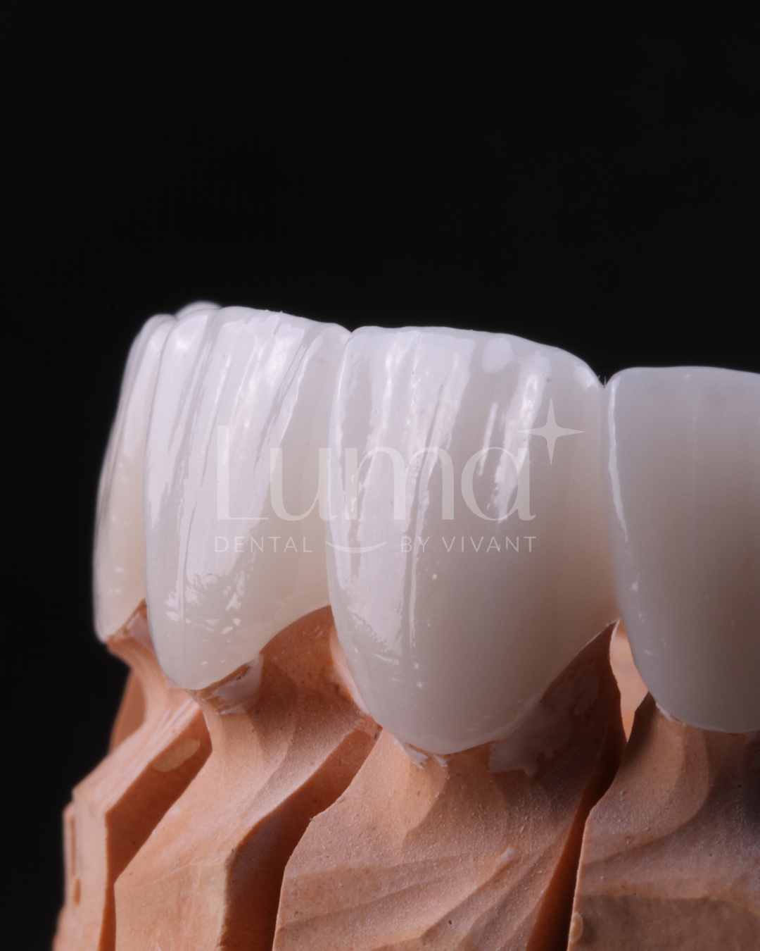 Dental Crown in LUMA