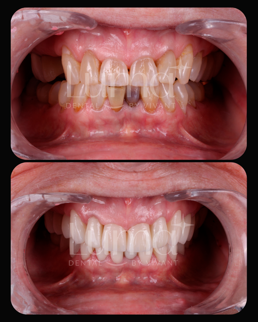 LUMA-LOSALGODONES2