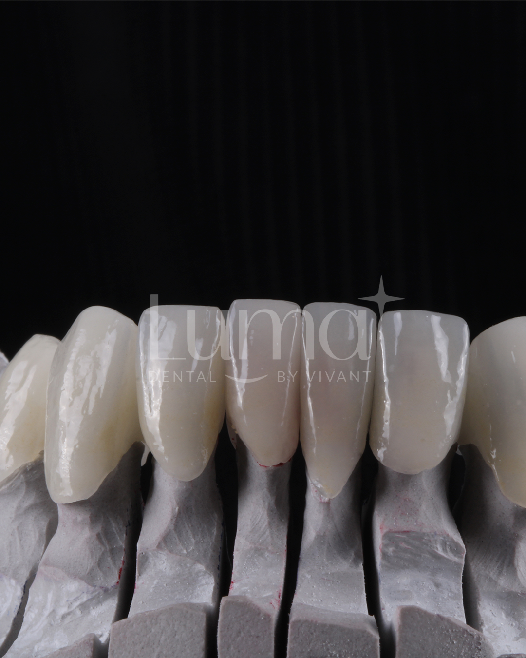 Oral Rehabilitation at LUMA Dental3